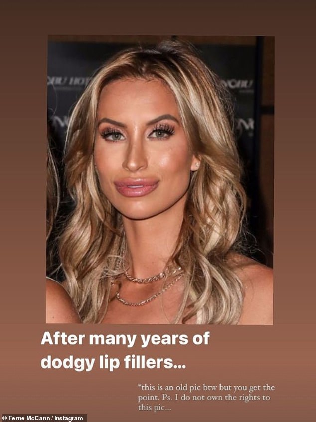 However Ferne took a 360 on her lip filler last year after she had her injectables dissolved and expressed her regrets over the cosmetic procedure