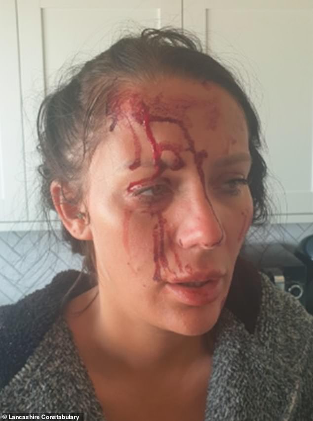 Just 11 days before her suicide, Ms Dawes suffered an horrific head wound after being attacked by her partner (Ms Dawes is seen with blood over her face in an image released today by police)