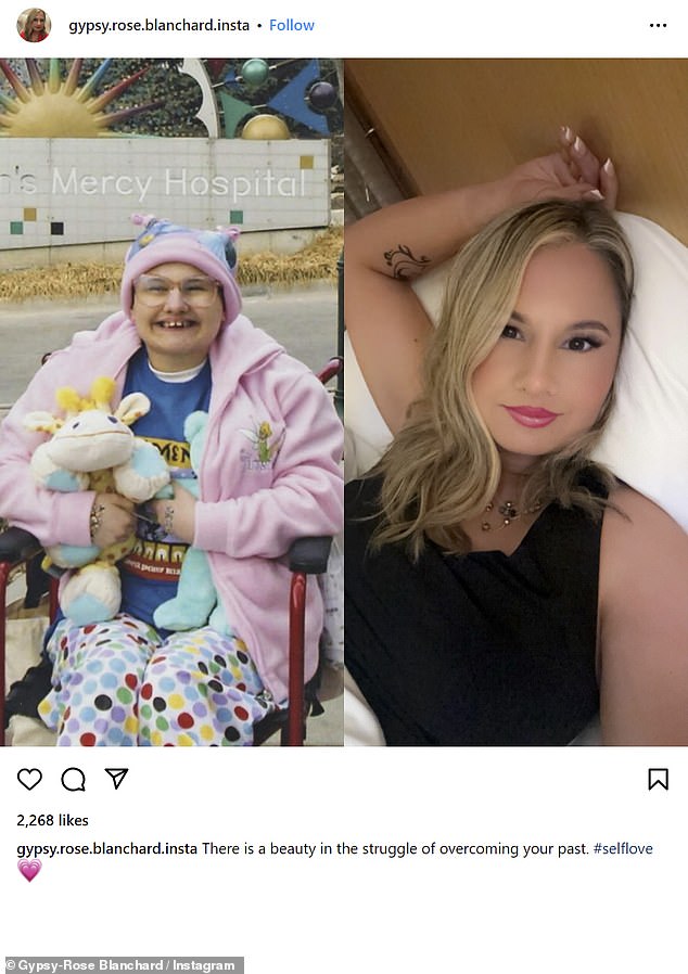 She shared a photo from her past next to a recent selfie alongside a caption about 'overcoming the past' earlier this month