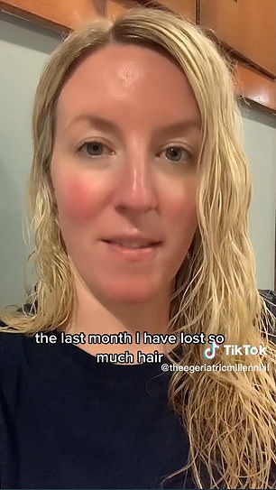 An American woman on Mounjaro said on her TikTok her hair was falling out in clumps when she brushed it or showered