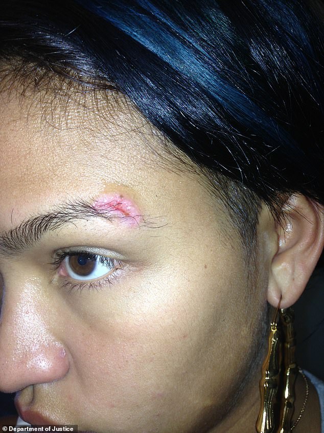 In another picture Cassie was seen with a large cut over her left eye, which she claimed she sustained in Canada when Diddy threw her into a bed frame