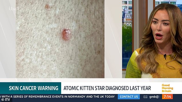The 42-year-old thought that she had been bitten while on holiday, but then after four weeks, realised that it was something else (pictured)