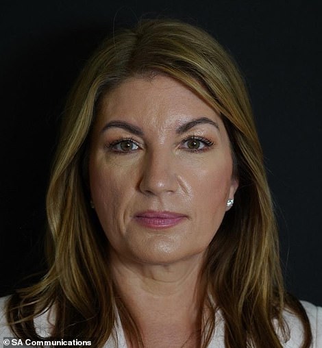 Karen after the treatment
