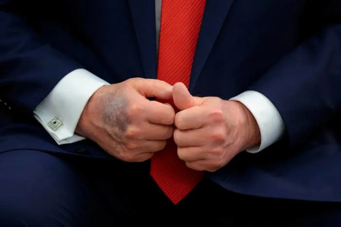 Close-up of a person wearing a suit, clasping their hands together