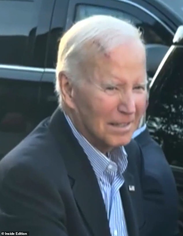 Biden is pictured without the bandage in this more recent footage from Inside Edition. This came from earlier in September while the former president was at church in Rehoboth Beach, Delaware