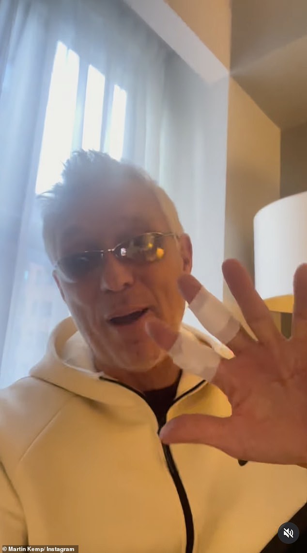 The musician and actor, 64, injured his hand after picking up the tool by the blade to cut a piece of wood