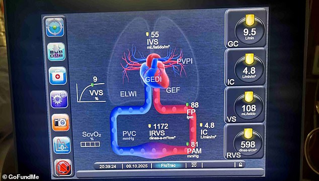 While Grigorov's operation went well initially, two days later she developed a severe infection that led to septic shock and heart failure