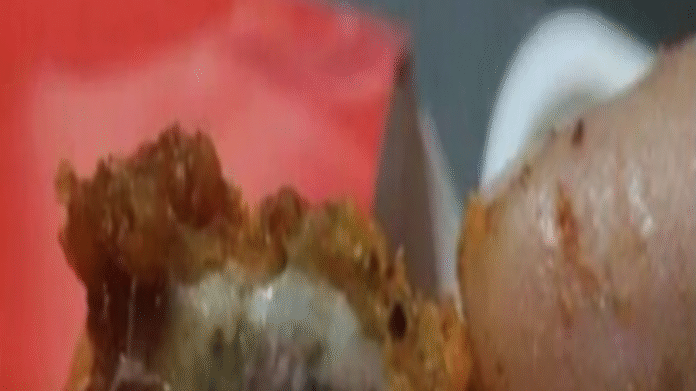 Redditor shares woes of receiving ‘fungus-laden’ chicken, when all he In the chats, the support executive can be seen saying that Zomato doesn't directly handle the cooking or taste.
