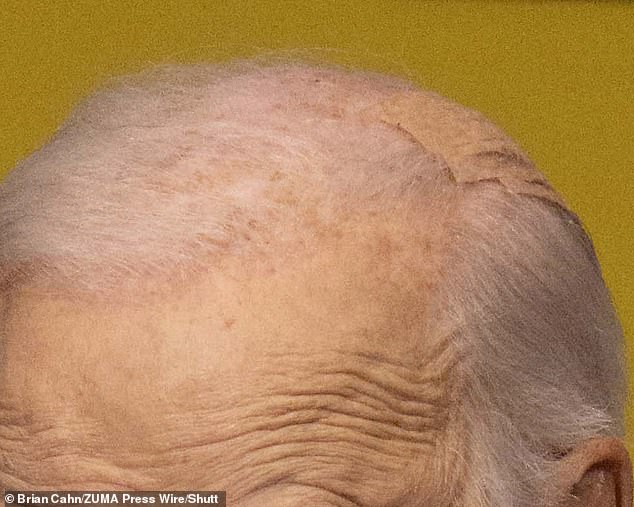 Biden did not explicitly mention the bandage, and it is unclear why he wore it