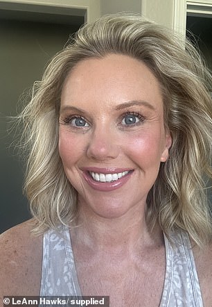 LeAnn Hawks pictured after her facelift