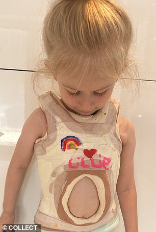 Despite undergoing three procedures and having to wear a brace [pictured] they were unsuccessful